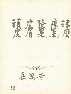 头皮发痒很多头皮屑是怎么回事,怎么解决封面