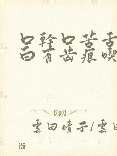 口干口苦舌苔厚白有齿痕吃什么药