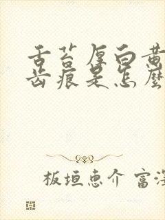 舌苔厚白黄腻有齿痕是怎么回事