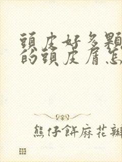 头皮好多颗粒状的头皮屑怎么回事