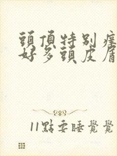 头顶特别痒,有好多头皮屑是怎么回事封面