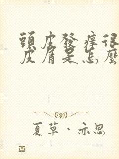 头皮发痒很多头皮屑是怎么回事,怎么解决