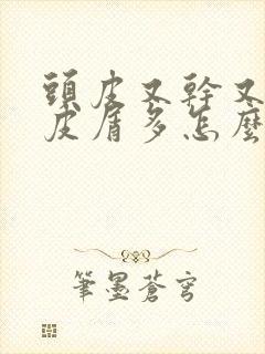 头皮又干又痒头皮屑多怎么回事