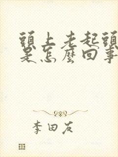 头上老起头皮屑是怎么回事