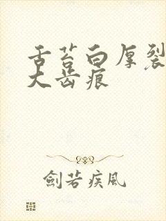 舌苔白厚裂纹肥大齿痕