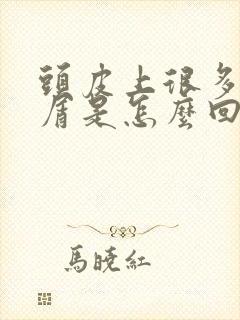 头皮上很多头皮屑是怎么回事