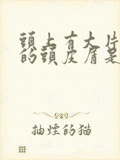 头上有大片大片的头皮屑是怎么回事