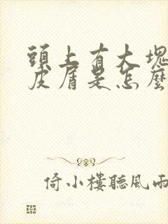 头上有大块的头皮屑是怎么回事