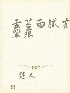 舌苔白腻有齿痕裂痕封面