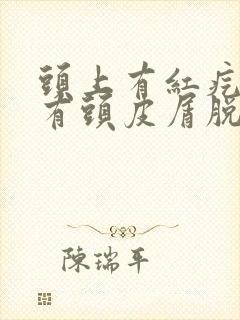 头上有红疙瘩痒有头皮屑脱发封面