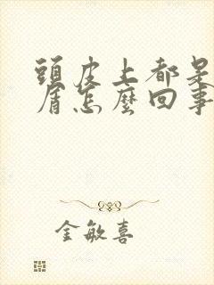 头皮上都是头皮屑怎么回事