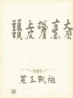 头上总有大块的头皮屑怎么回事