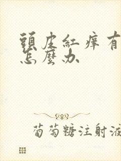 头皮红痒有头屑怎么办