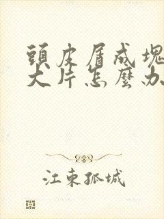 头皮屑成块状一大片怎么办