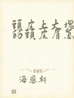 头皮上大块大块的头皮屑怎么回事