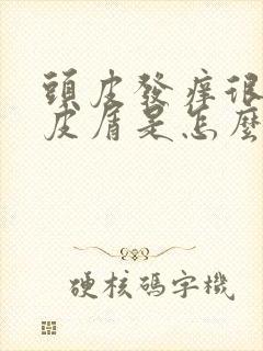 头皮发痒很多头皮屑是怎么回事,怎么解决