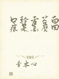 口干舌苔白有齿痕是怎么回事封面