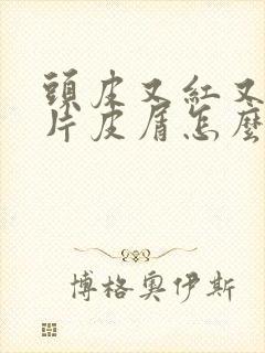 头皮又红又痒大片皮屑怎么治疗