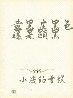 黄黑皮黑色显白还是显黑