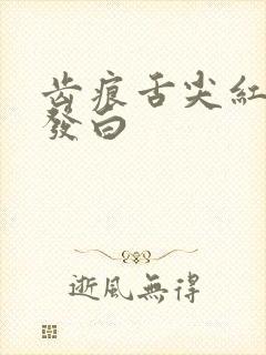 齿痕舌尖红舌苔发白