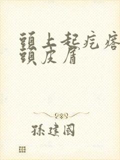 头上起疙瘩还有头皮屑