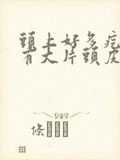 头上好多疙瘩还有大片头皮屑封面