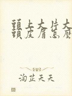 头上大片大片的头皮屑怎么治