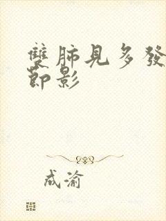 双肺见多发微结节影