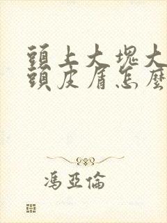 头上大块大块的头皮屑怎么治疗