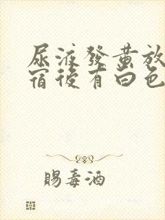 尿液发黄放置一宿后有白色沉淀物