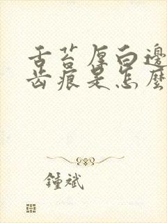 舌苔厚白边缘有齿痕是怎么回事