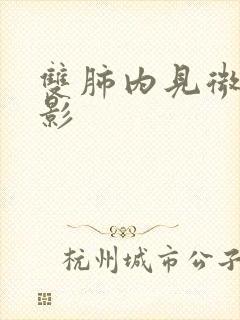 双肺内见微结节影