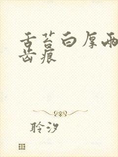 舌苔白厚两侧有齿痕