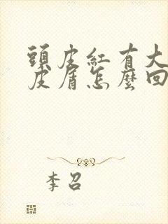 头皮红有大片头皮屑怎么回事