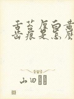 舌苔厚白黄腻有齿痕是怎么回事