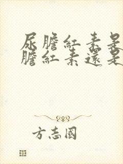 尿胆红素是结合胆红素还是非结合胆红素