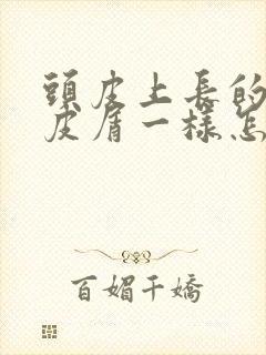 头皮上长的像头皮屑一样怎么回事