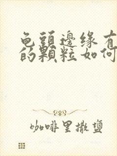 龟头边缘有白色的颗粒如何治疗