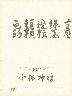 龟头边缘有白色的颗粒怎么回事