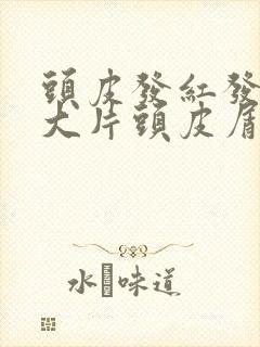 头皮发红发痒有大片头皮屑怎么办封面