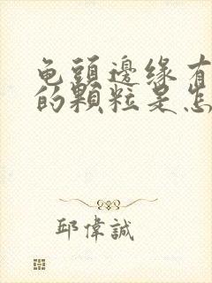 龟头边缘有白色的颗粒是怎么回事