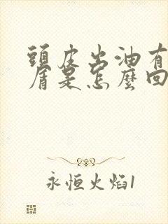 头皮出油有头皮屑是怎么回事