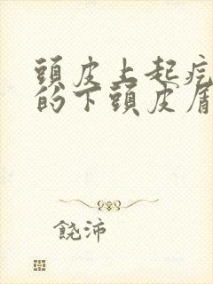 头皮上起疙瘩扣的下头皮屑