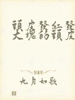 头皮发红发痒有大块的头皮屑是怎么回事