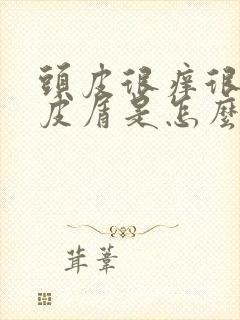 头皮很痒很多头皮屑是怎么治疗