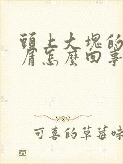 头上大块的头皮屑怎么回事