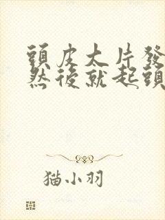 头皮大片发红,然后就起头皮屑是怎么回事