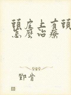 头皮上有头皮屑怎么治疗