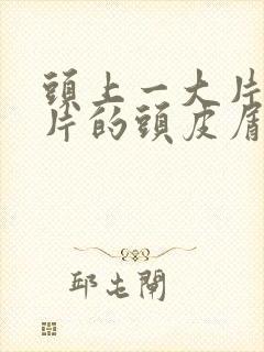 头上一大片一大片的头皮屑该怎么办