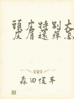 头皮特别大片头皮屑还痒怎么办